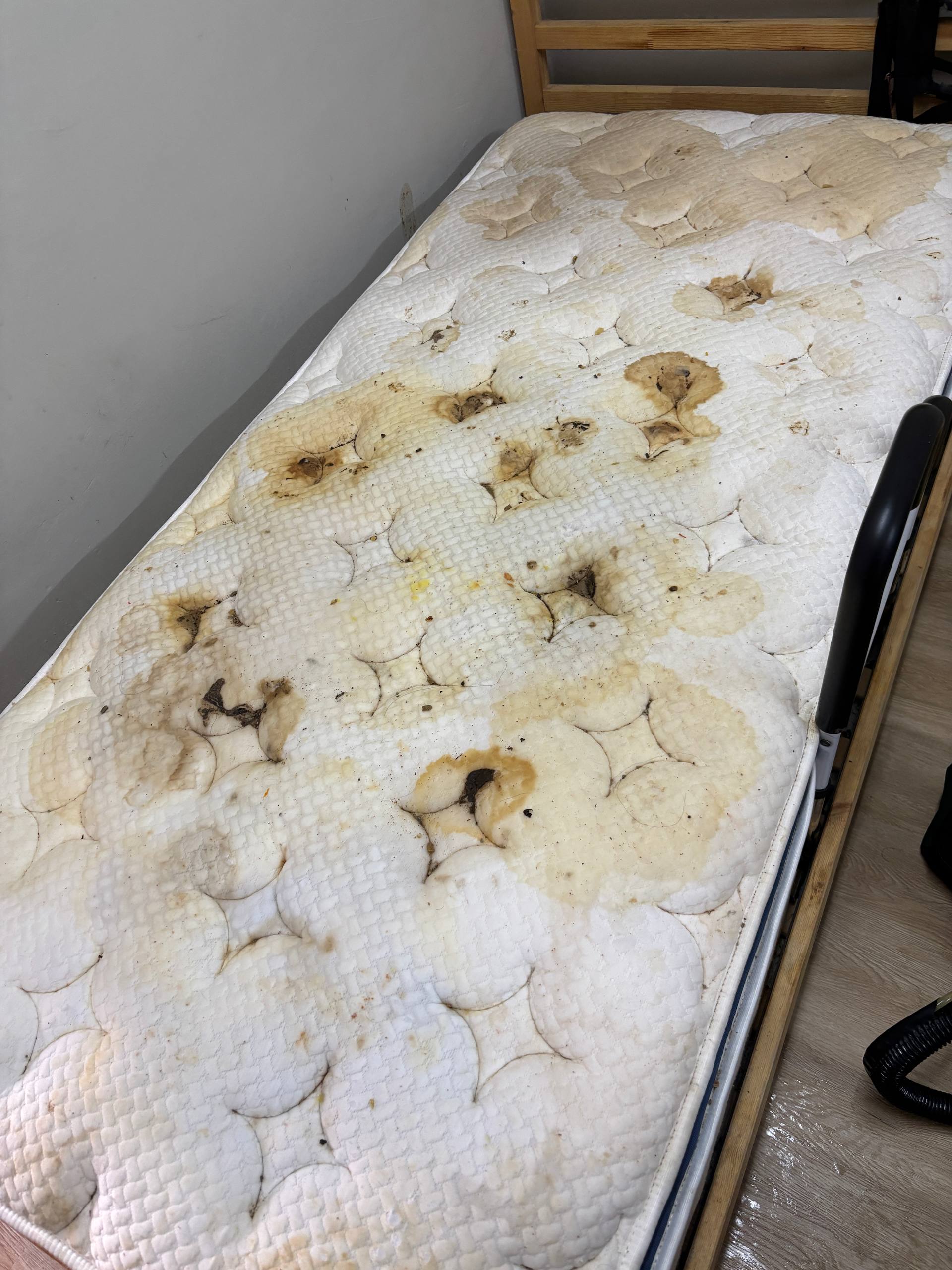 Before deep cleaning treatment